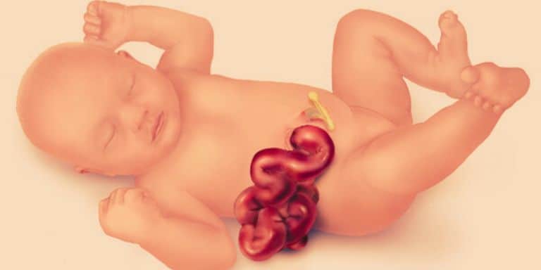 Gastroshiza